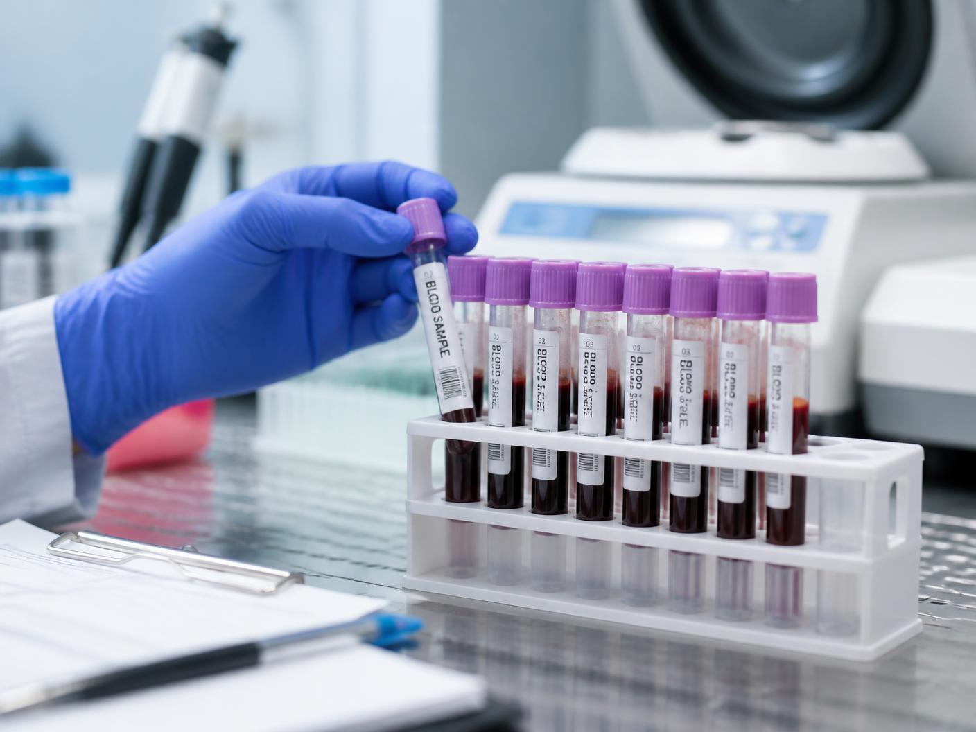 Blood samples being handled in the pathology lab